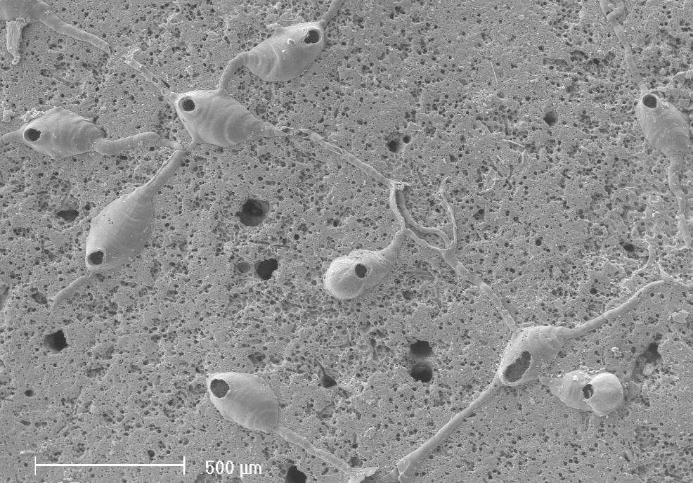 Hippothoa flagellum (door Hans De Blauwe)