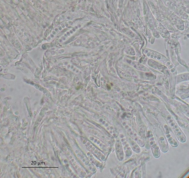 Hyalorbilia erythrostigma (door Laurens van der Linde)