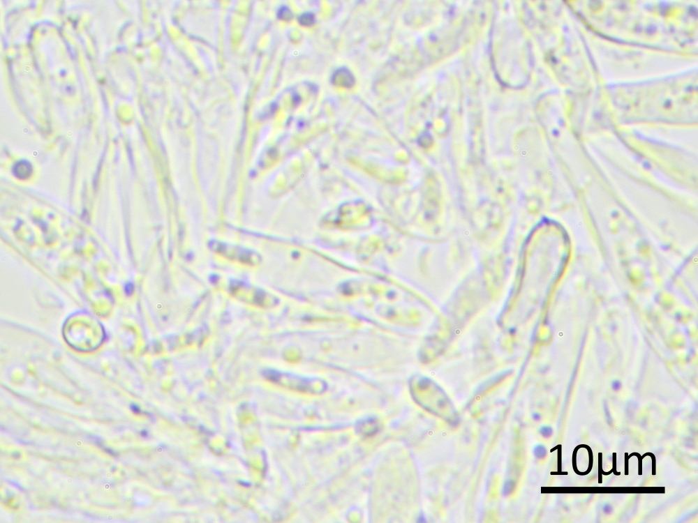 Hyphodiscus ucrainicus (door Henk-Jan van der Kolk)