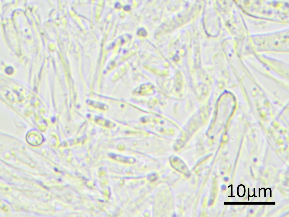 Hyphodiscus ucrainicus (door Henk-Jan van der Kolk)