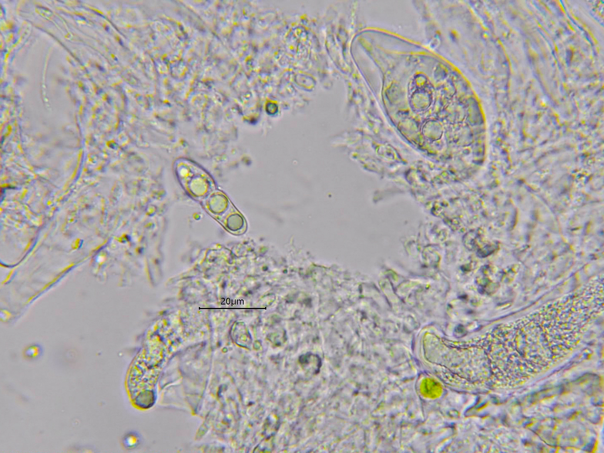 Mycoporum antecellens (door Wim de Groot)