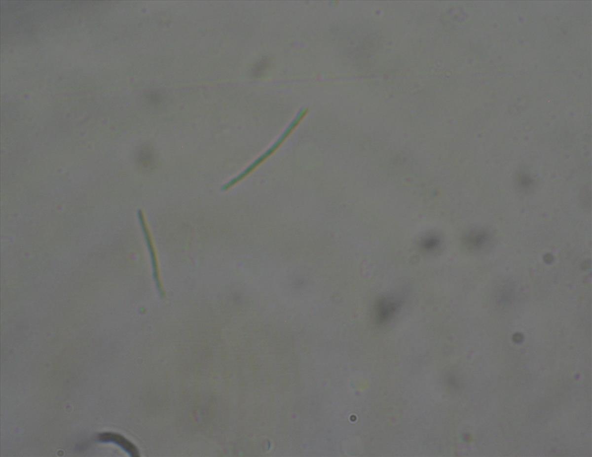 Hyperphyscia adglutinata (door Arno van der Pluijm)