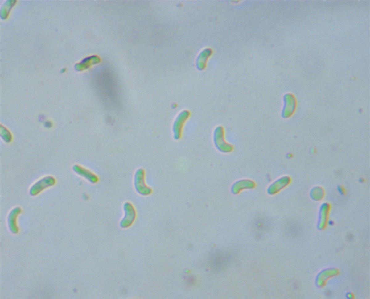 Pseudoschismatomma rufescens (door Arno van der Pluijm)