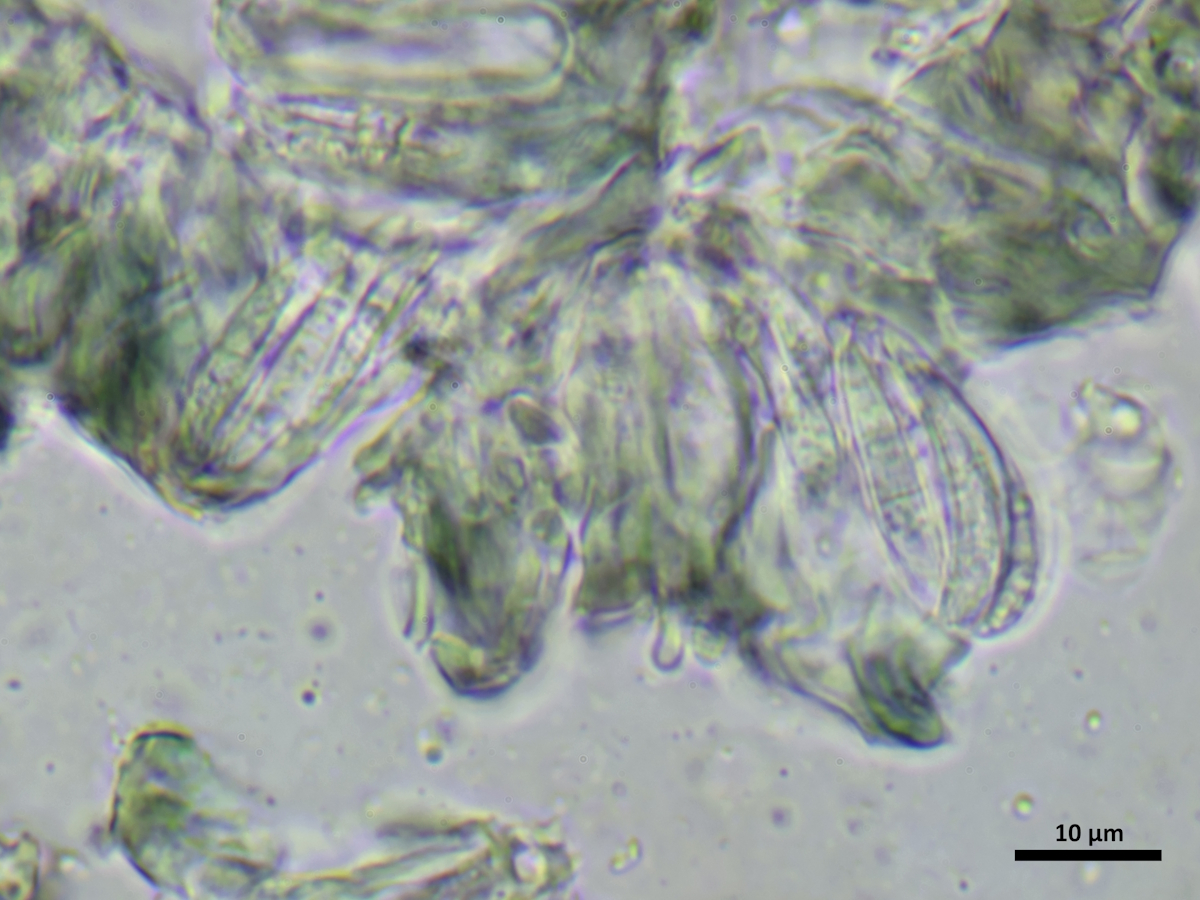 Scoliciosporum micareae (door Henk-Jan van der Kolk)