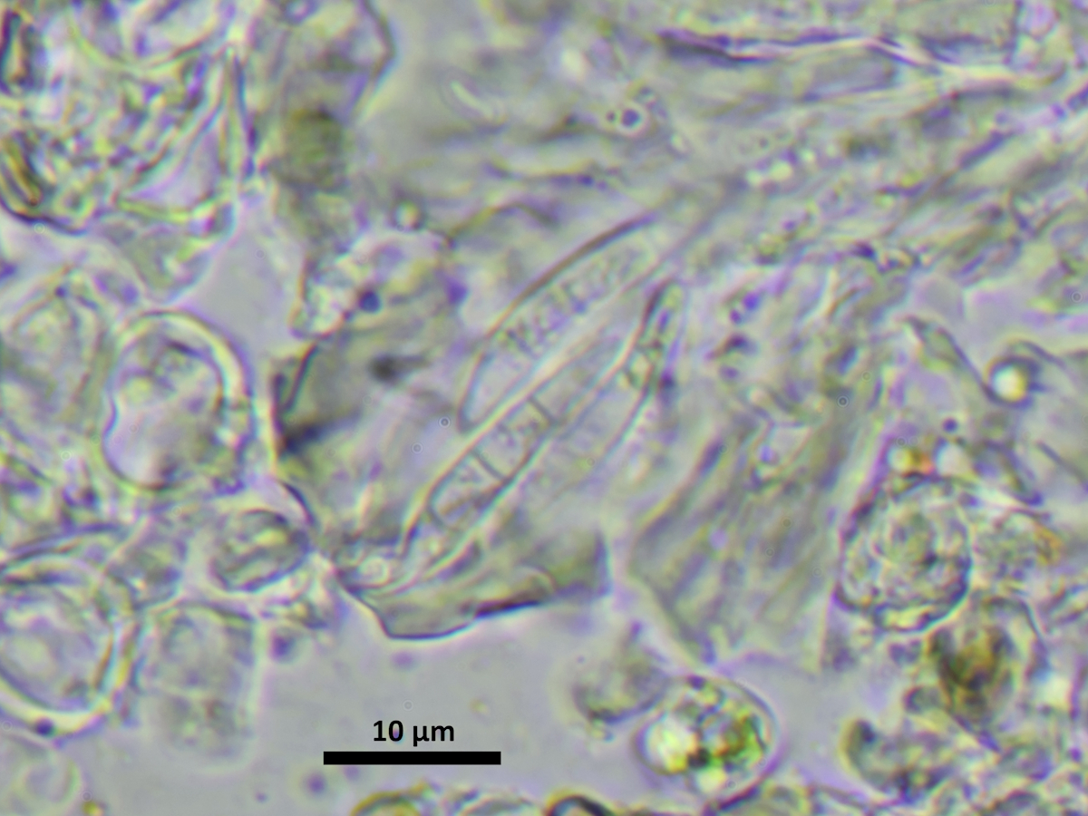 Scoliciosporum micareae (door Henk-Jan van der Kolk)